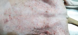 NEOPLASIAS CUTÂNEAS EM CÃES E GATOS​